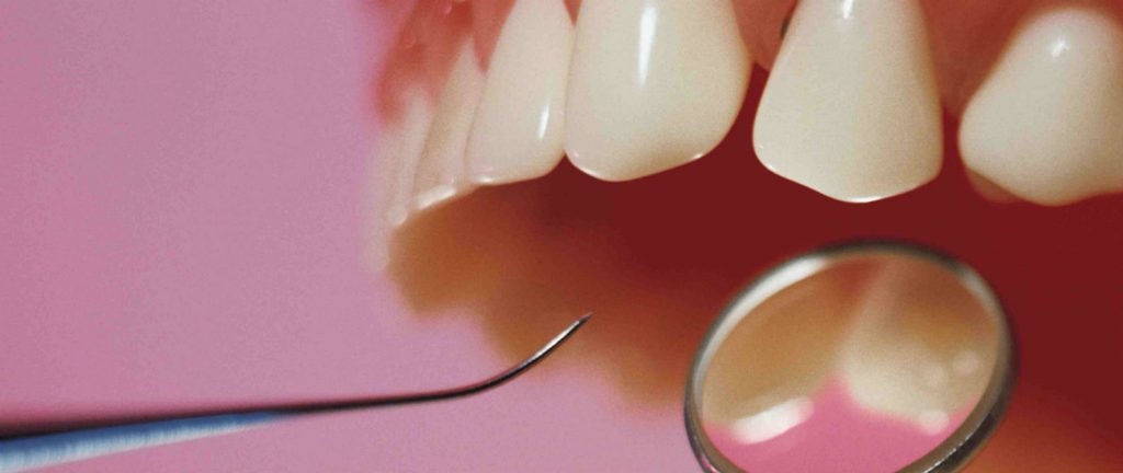 Cinco Beneficios De Las Resinas Dentales Odontotecks