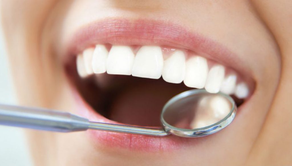 ¿Qué es una limpieza dental ultrasónica?
