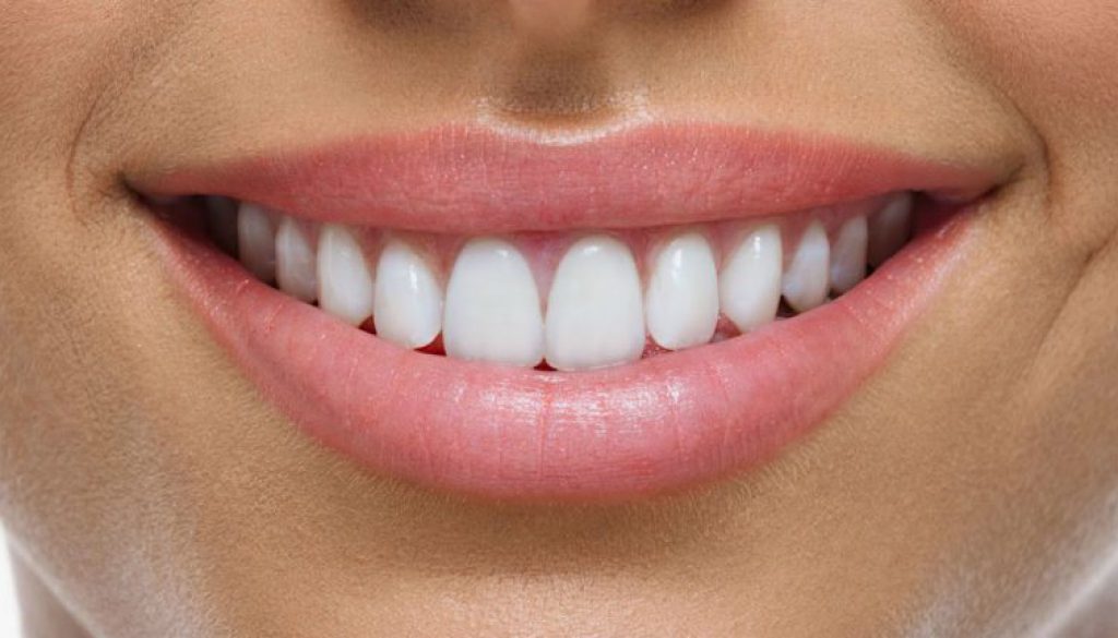 Beneficios de las carillas dentales