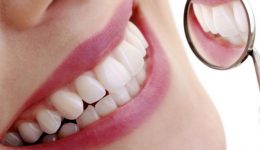 diferencias entre las carillas y coronas dentales