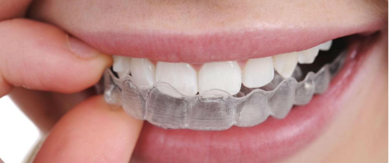 Tips contra el rechinado de dientes