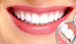 La importancia de la limpieza dental